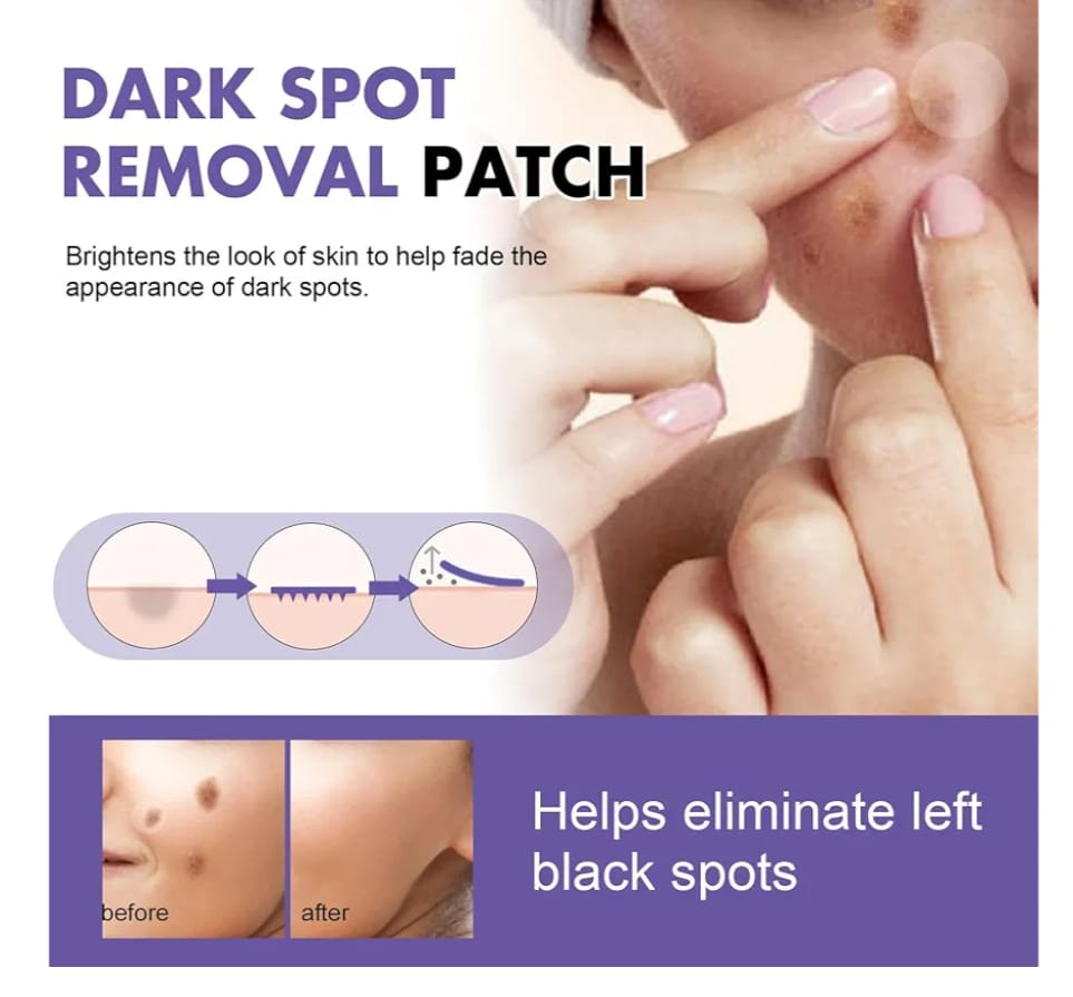 Parches para Manchas Oscuras – Cuidado Facial